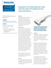 Evaluation of a fetal adrenal mass with the eL18-4 PureWave linear array transducer case study pdf thumbnail