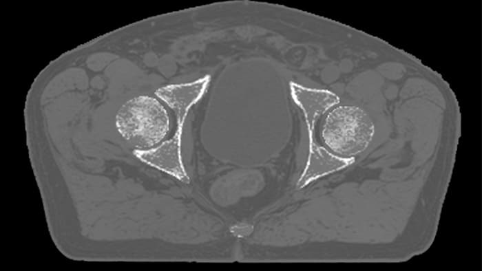 magnetic resonance Therapy HCNMRF267