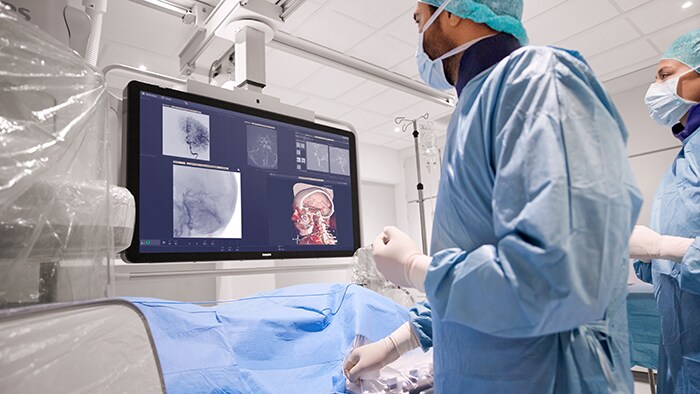 Philips accelerates stroke diagnosis and treatment with expanded integrated solutions and strategic partnership