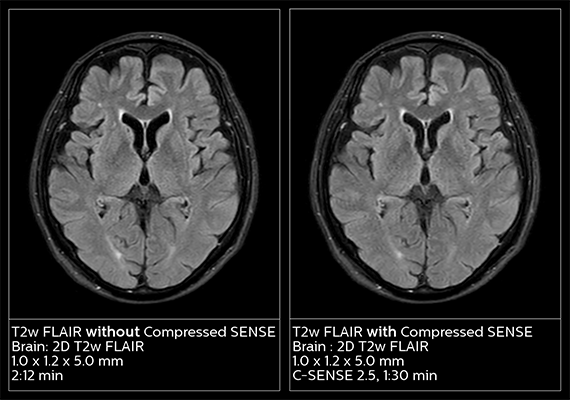 t2w flair magnetic resonance imaging