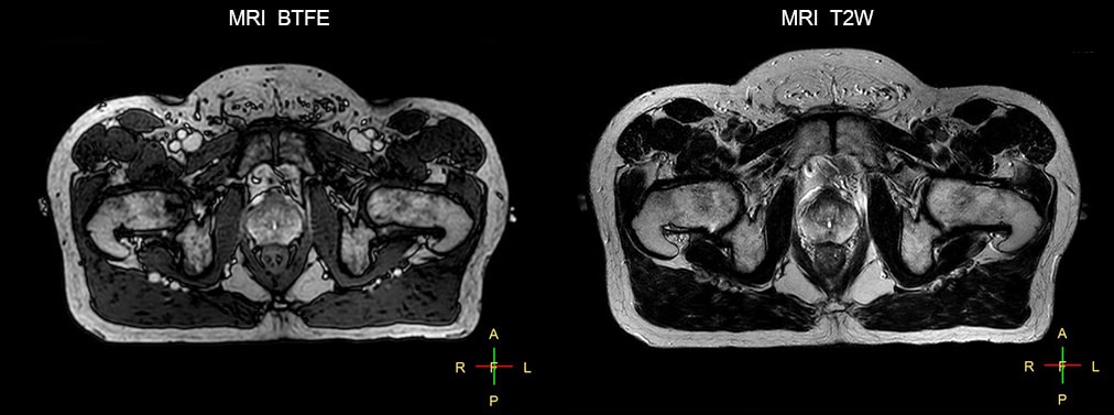 fieldstrength ingenia clinical case 2 1