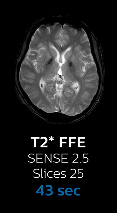 T2 FFE magnetic resonance imaging