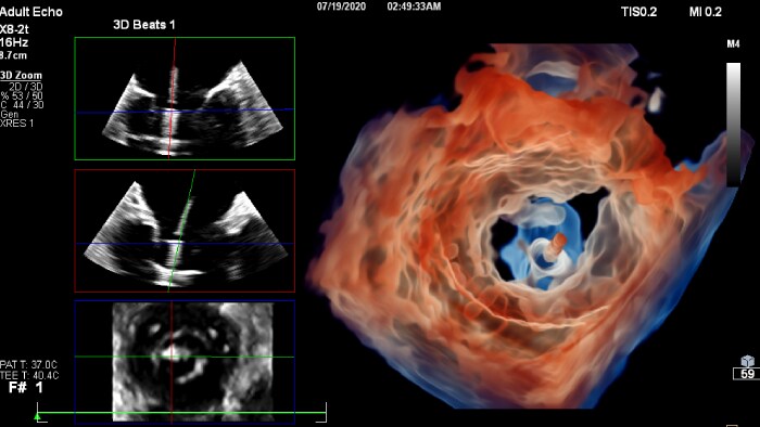 Cardiovascular  Ultrasound