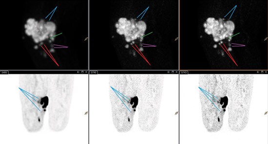 xfine 4mm scan