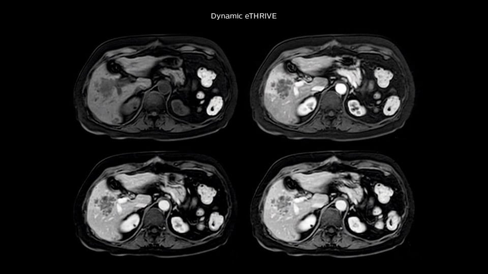 Bremen Clinical case liver MRI