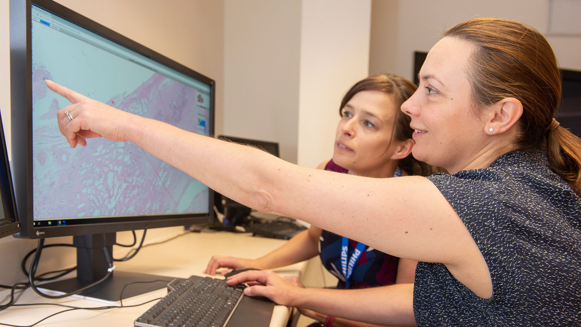 Philips and Oxford University Hospitals NHS Foundation Trust team up to deploy innovative digital pathology network